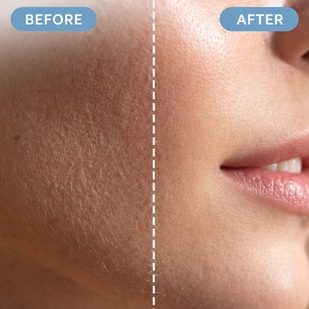 Covers Everything in One Place